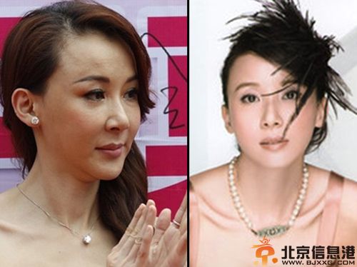 疑萧蔷整容失败前后对比照 萧蔷春光外泄凸点图片揭个人资料