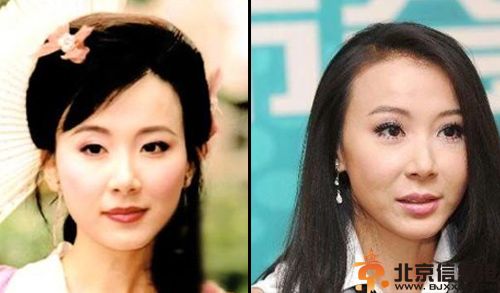 疑萧蔷整容失败前后对比照 萧蔷春光外泄凸点图片揭个人资料