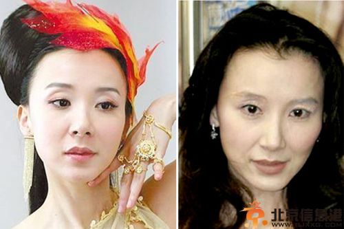 疑萧蔷整容失败前后对比照 萧蔷春光外泄凸点图片揭个人资料