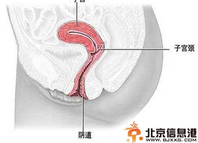 了解妇科疾病有哪些症状 自测你是否有妇科病做到早发现早治疗