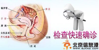慢性盆腔炎的症状有哪些 教你如何自己护理最好