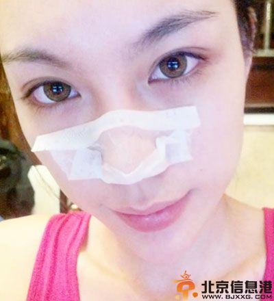 简单去黑头的方法 可用珍珠粉揉搓