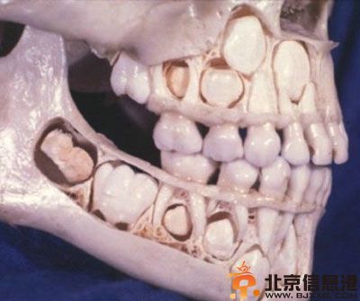 重口味图片胆小者慎入 揭秘人的脸皮到底有多厚