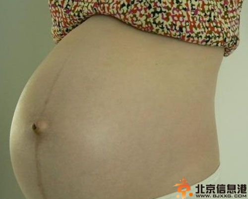 妊娠斑能消除吗 妊娠斑是怎么形成的怎么去除