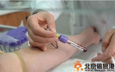 女性孕前检查有哪些项目 让你轻松拥有健康宝宝