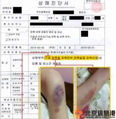 金贤重家暴女友被起诉 经纪公司否认其家暴事件
