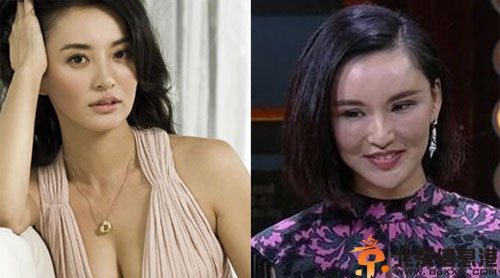 莫小棋整容前后对比照个人资料 被吐槽整容失败