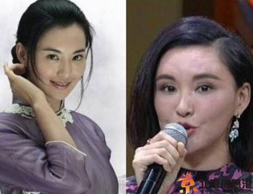 莫小棋整容前后对比照个人资料 被吐槽整容失败