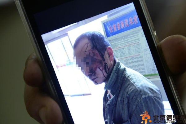 当浪漫约会变为传销陷阱 千里来相见却被暴打