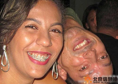巴西男子Claudio资料照片 克劳迪奥天生头部颠倒