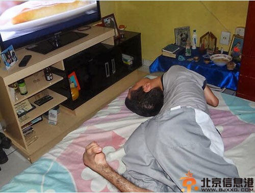 巴西男子Claudio资料照片 克劳迪奥天生头部颠倒