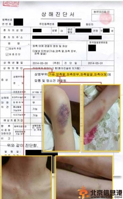 金贤重家暴女友是谁 曝女友受伤照片最新进展