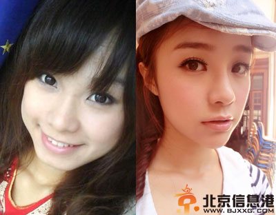 徐佳琦老公是谁 凸点遭搜疑曝比基尼整容前后照
