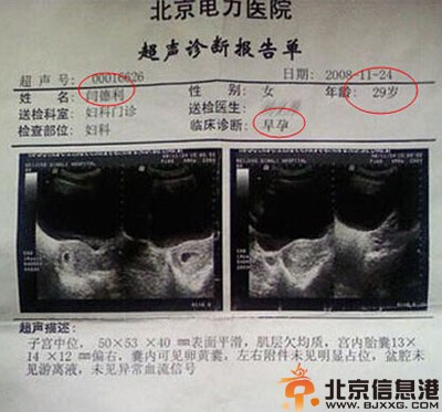 闫德利事件完整照片及近况 艾滋门真相系杨勇猛诽谤