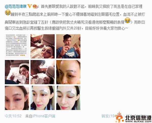 范玮琪脸部受伤图片曝光 缝25针吓坏黑人建州