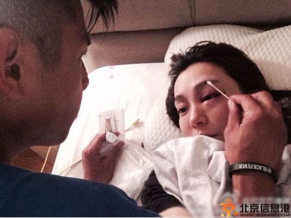范玮琪脸部受伤图片曝光 缝25针吓坏黑人建州