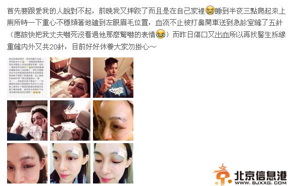 范玮琪摔倒缝针眼睛红肿 黑人悉心照料