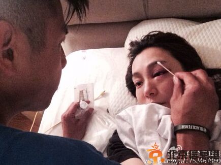范玮琪摔倒缝针眼睛红肿 黑人悉心照料