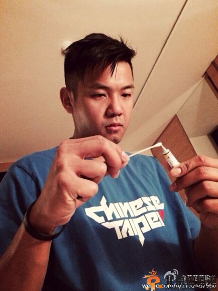 范玮琪摔倒缝针眼睛红肿 黑人悉心照料