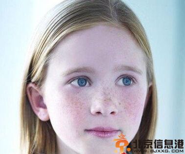 了解女人脸上长斑的原因 斩断长斑源头