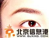 如何方便快速贴双眼皮贴