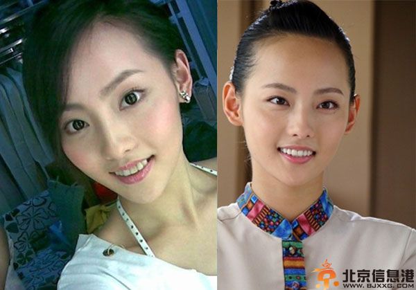 张嘉倪整容前后对比照疑曝光 网友直呼不相信