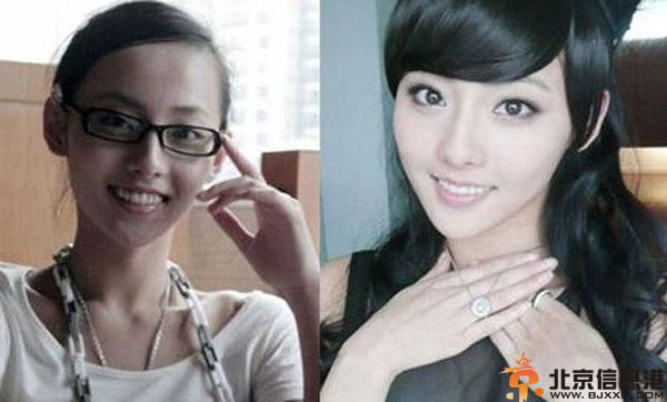 张嘉倪整容前后对比照疑曝光 网友直呼不相信