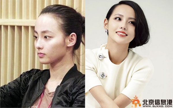 张嘉倪整容前后对比照疑曝光 网友直呼不相信