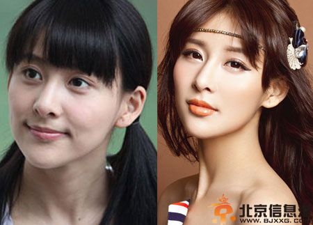 贾青整容前后对比照疑被爆 揭其个人资料粉丝力挺原装