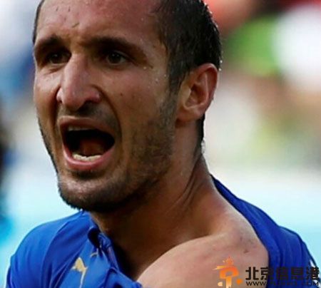 苏亚雷斯咬人事件图片 网友调侃舌尖上的苏亚雷斯