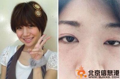 林沙织自杀个人资料照片受关注 揭救活后脸半残图