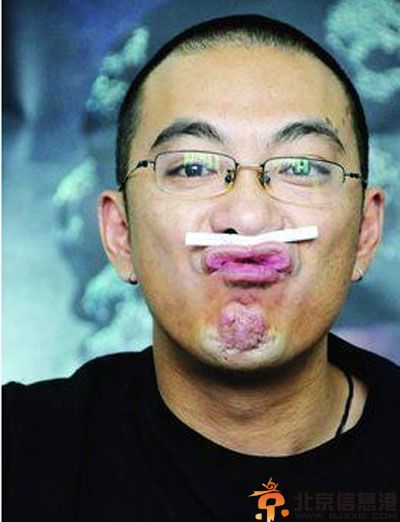 宁财神吸毒被抓内幕图片 与张元吸毒事件有关揭其资料照片