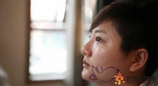 “超女”王梓整容视频流出 大方承认