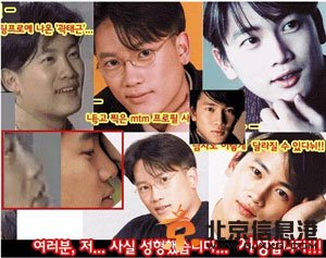 池城个人资料 池城整容前后对比照