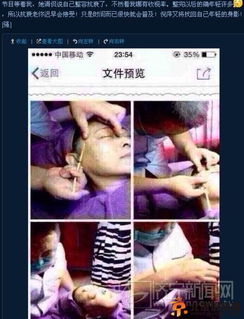 倪萍复出整容过程疑曝光 动刀填平额头眼角皱纹