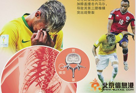 【巴西之殇】内马尔重伤告别队友心慌慌 巴西VS德国谁主沉浮？