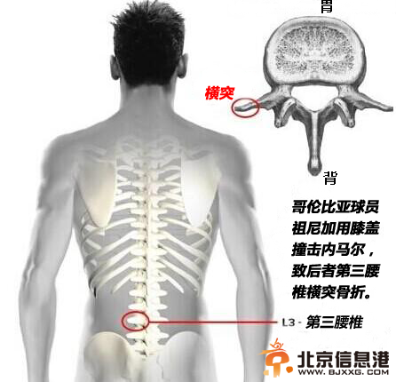 噩耗！内马尔伤情确认 椎骨骨裂告别世界杯