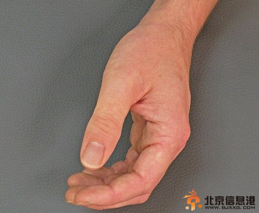 德国硅胶制精致假肢仿真度极高 肉眼无法识别