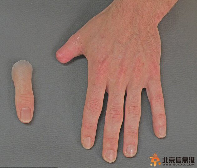 德国硅胶制精致假肢仿真度极高 肉眼无法识别