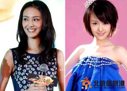 郑爽整容后张翰惊呆完全认不出 郑爽整容前后照片对比