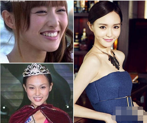 唐嫣18岁龅牙照曝光被疑整容 网友：女大十八变
