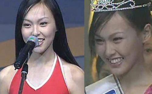 唐嫣18岁龅牙照曝光被疑整容 网友：女大十八变