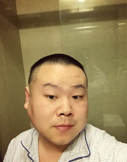 岳云鹏穿病号服乐观自拍 准备面部手术