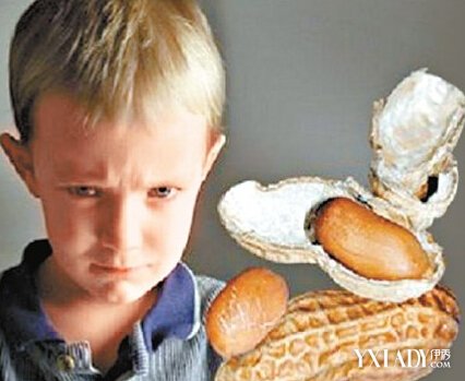 老干妈在澳下架 花生过敏“以毒攻毒”或可解除