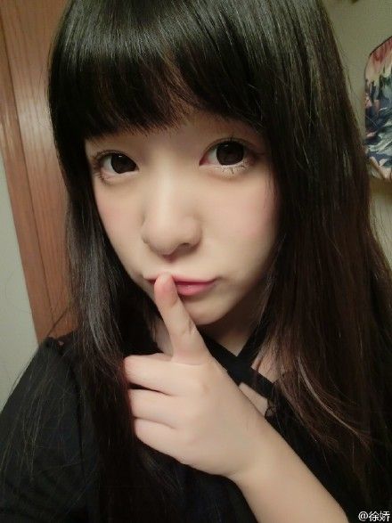 徐娇发微博称自己患有良性肿瘤 称会乐观面对手术