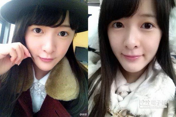 良性纵隔肿瘤是什么？传“星女郎”徐娇得良性纵隔肿瘤拒演出偶像剧