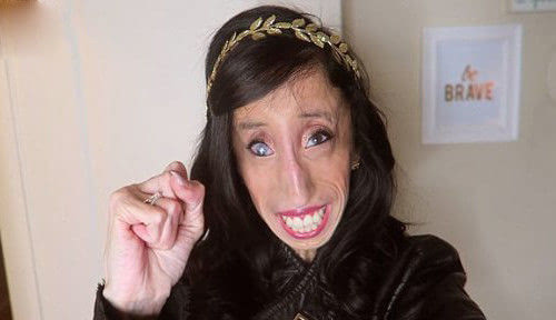 美国“世界最丑的<a href='http://www.bjxxg.cn/health/liangxing/' target='_blank'><u>女人</u></a>”笑对人生 网民叫她自行了断