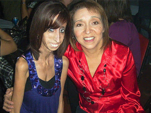 美国“世界最丑的女人”笑对人生 网民叫她自行了断