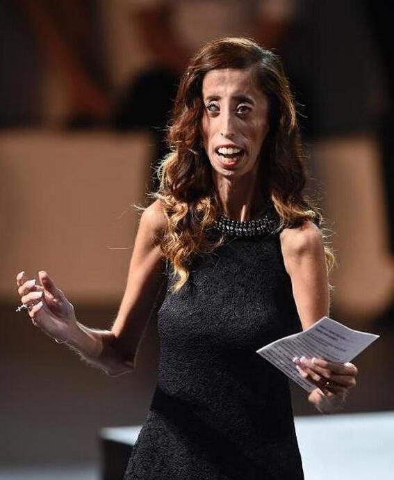 美国“世上最丑女”拍励志纪录片 勇敢反欺凌