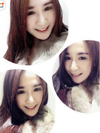 河南美女主播下班途中被宝马撞伤 美腿近二十厘米伤口至今肇事司机未找到
